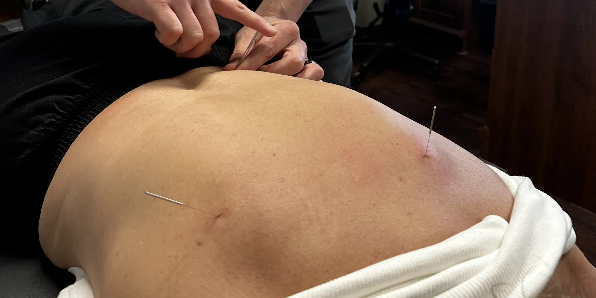 Able Body  Chiropractic Physiotherapy Acupuncture Massage